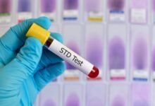 STD Testing